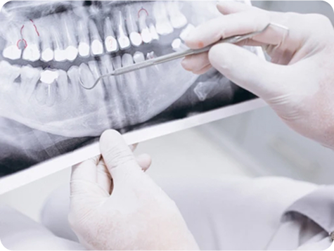 Implant Procedure Steps 1-5