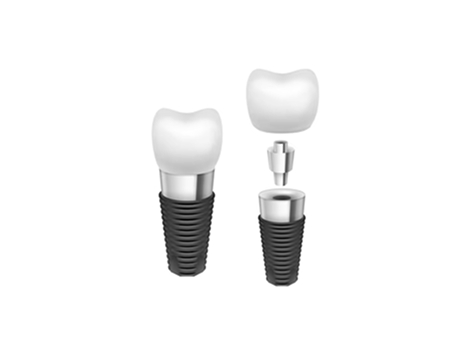 Dental implant in jawbone